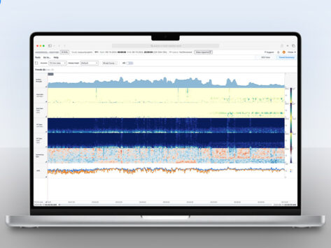 Lvis neuromatch access 1 21