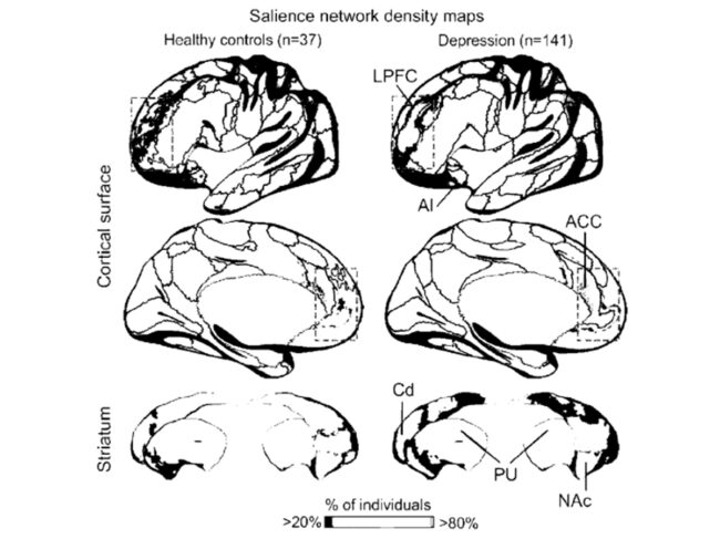 brain depression