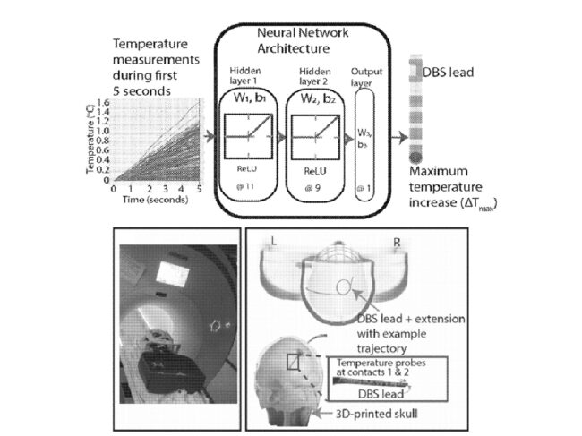 mri-safety