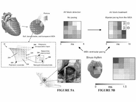 Soft microelectrode 10jan25