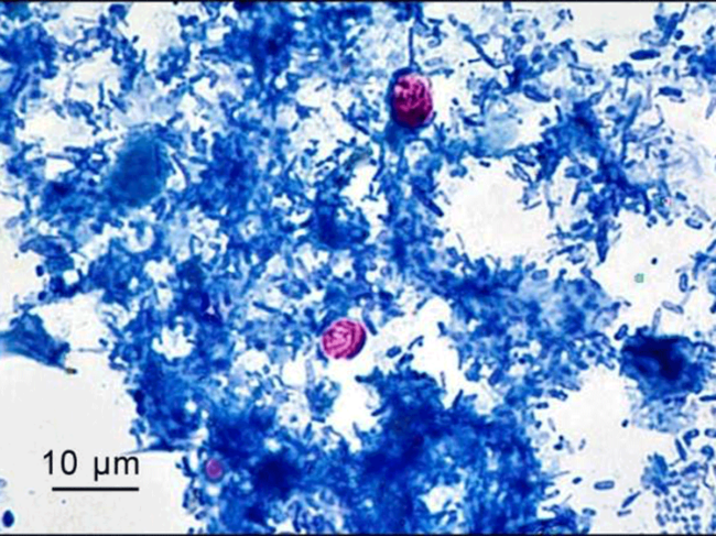 Optical microscopy showing Cryptosporidium