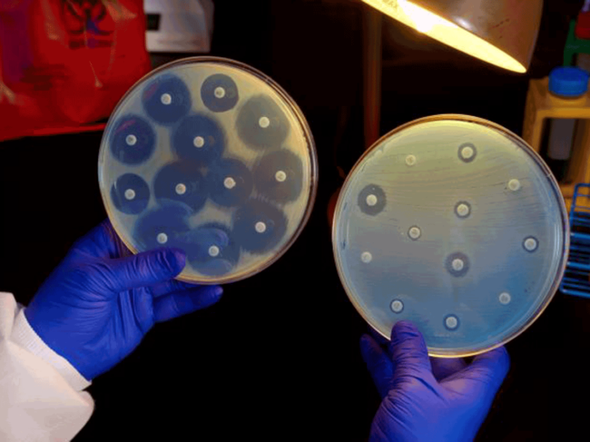 Antibiotic susceptibility testing