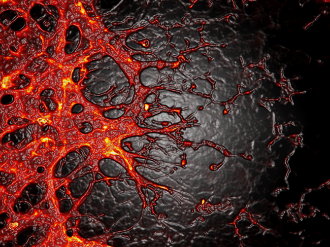 Diabetic retinopathy