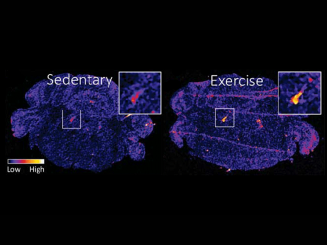 Galanin in the brainstem