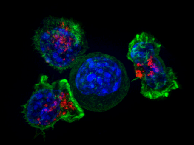 T cells attacking cancer cell