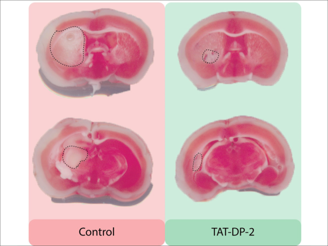 Peptide drug TAT-DP-2 spares brain tissue