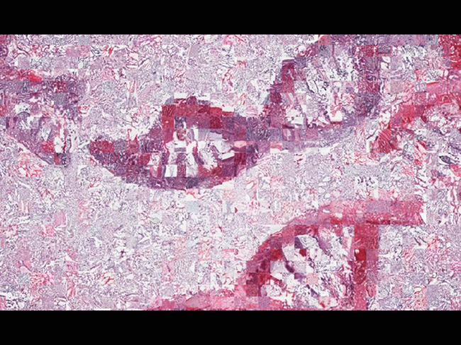 DNA mosaic