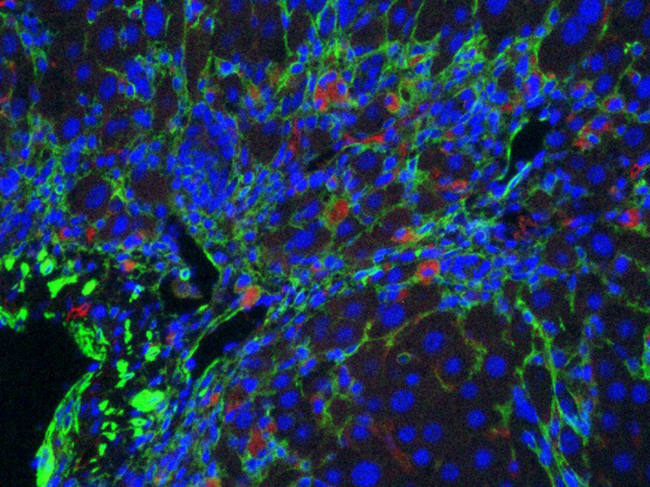 CAR T cells attacking senescent cells