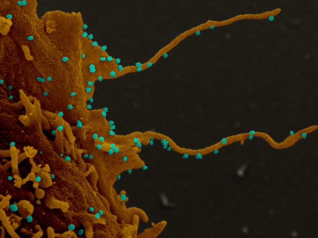 Cells infected with SARS-CoV-2