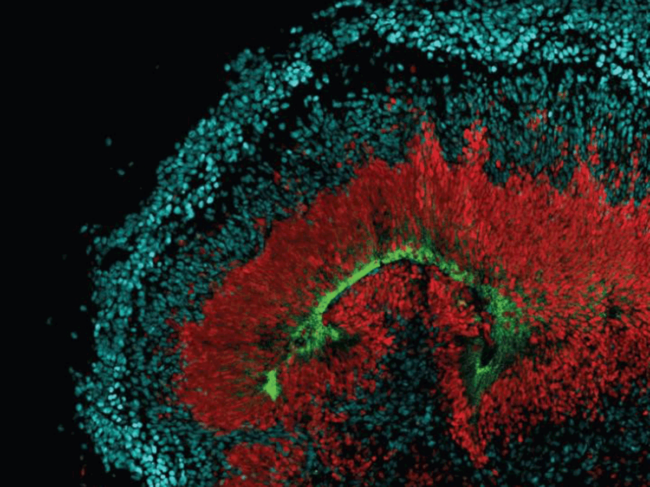 Stem cell-derived cerebral organoid