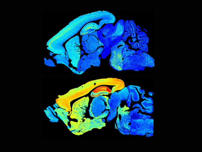 Young and adult mouse brains