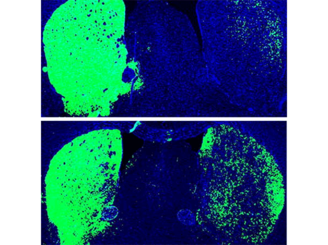 Dopaminergic neurons