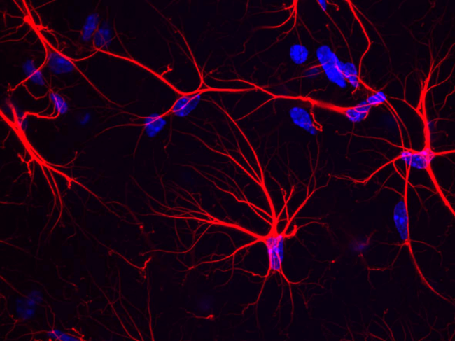 Astrocytes in the mouse hippocampus