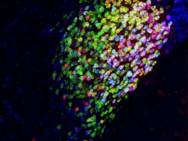 Neurons in the central amygdala of a mouse brain