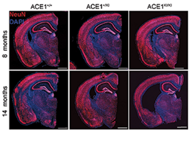 ACE1 brain sections