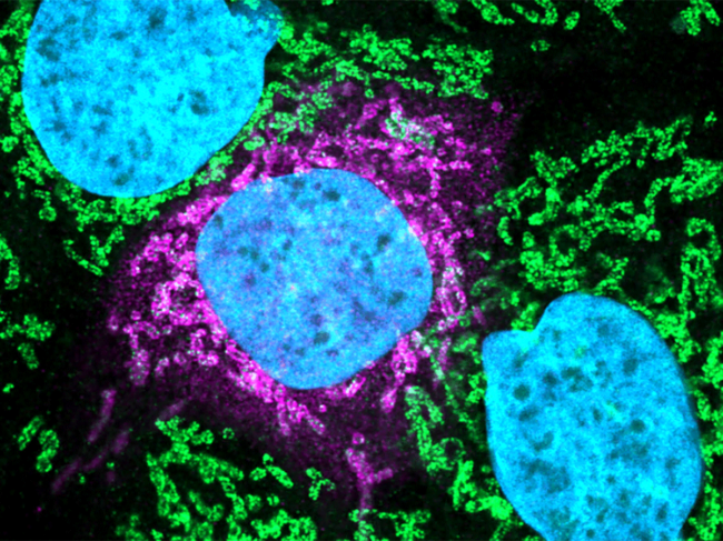 Human and coronavirus proteins