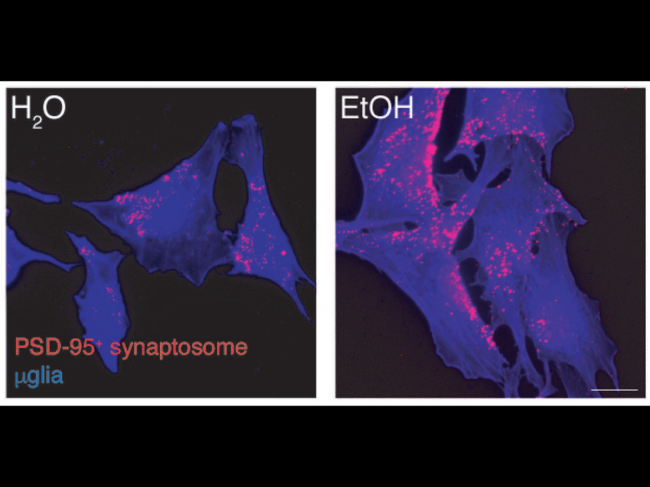 Microglia