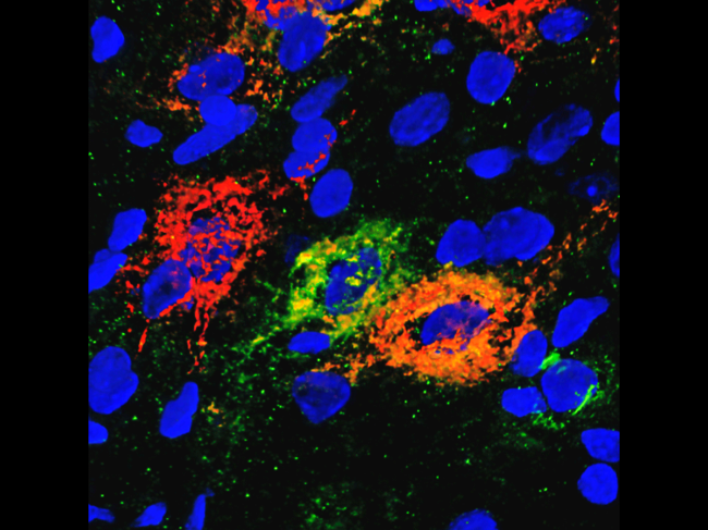 Glucose-regulating neurons