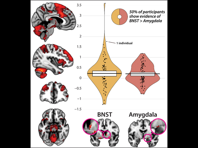 Brain circuits