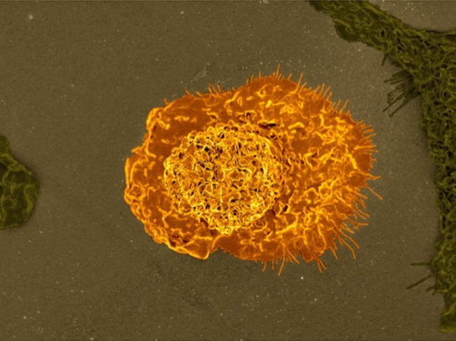 Immune macrophage