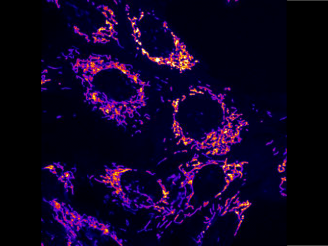 Fluorescence microscopy image of mitochondria