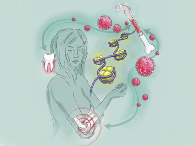 Inflammation illustration