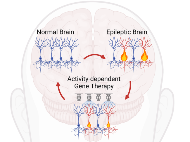 Brain illustration