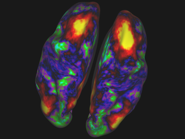 Cerebral cortex map 