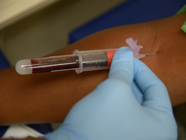 A laboratory technician waits for a vial to fill with blood from a patient.