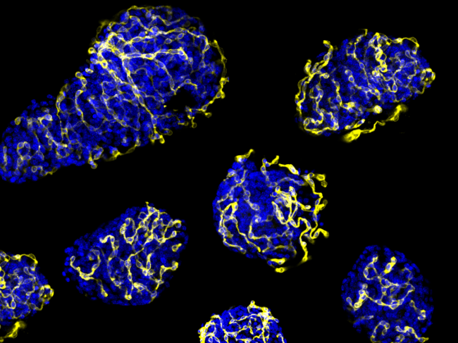 Colorized electron microscope image of transplanted pancreatic islets with functioning vasculature.