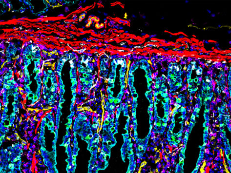 Hubmap intestine