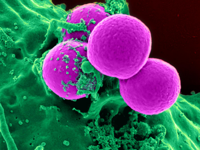 Microscopic image of Methicillin-resistant S. aureus.