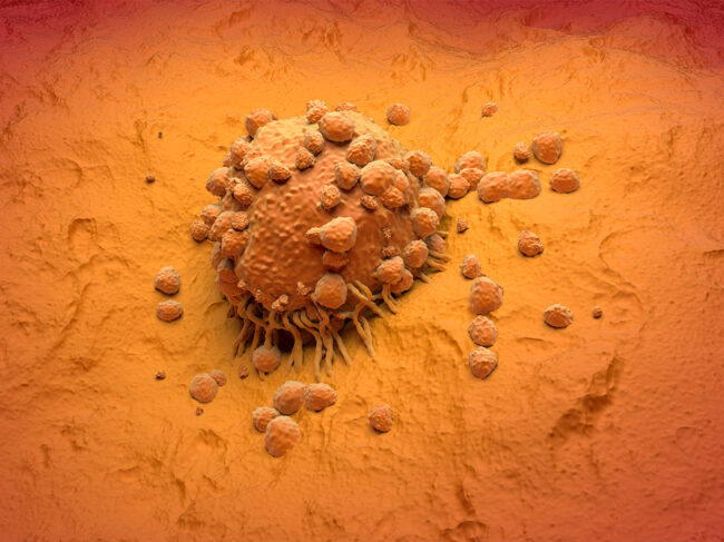 3D illustration of melanoma