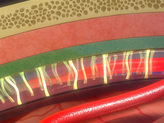 Illustration showing layers of the meninges between the skull and brain