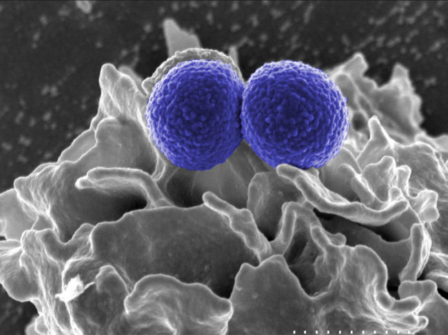 Scanning electron micrograph of MRSA interacting with a neutrophil