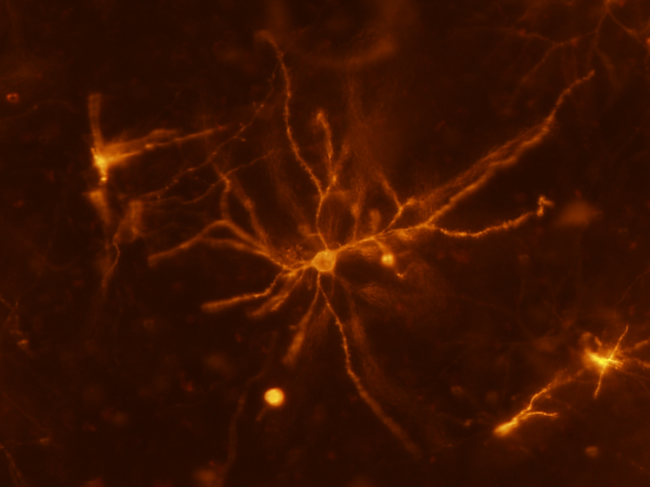 Mouse neuron.