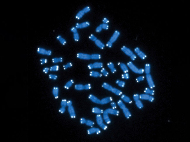 Image of human chromosomes with telomeres on ends