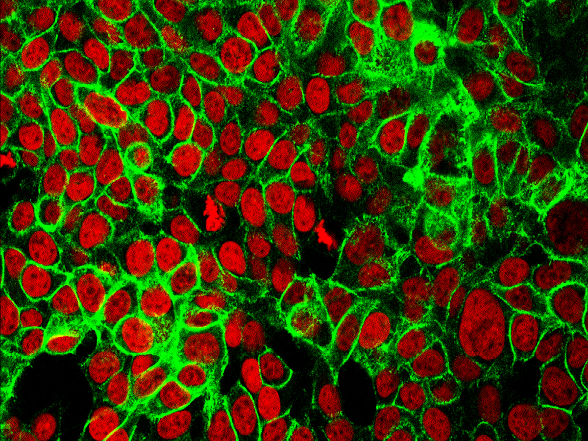 Human colon cancer cells.