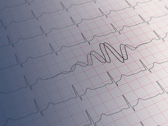 Concept art for irregular heart rhythms/arrhythmias caused by mutations in genes.