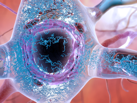 Nih nia alzheimers abnormal tau