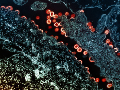 Transmission electron micrograph of HIV-1 virus particles 