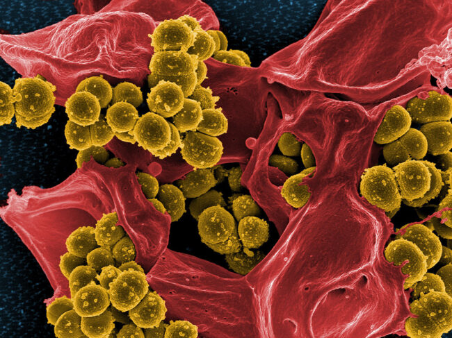 Colorized scanning electron micrograph of MRSA.