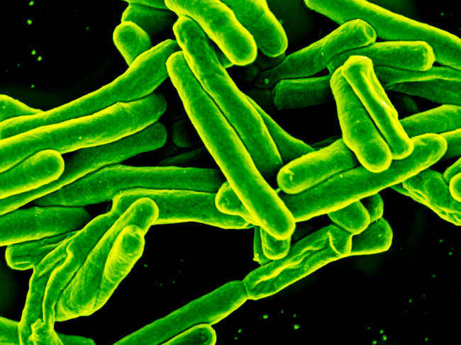 Colorized scanning electron micrograph of M. tuberculosis bacteria.