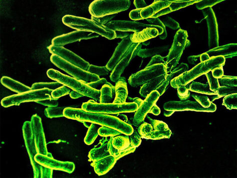 Scanning electron micrograph of M. tuberculosis