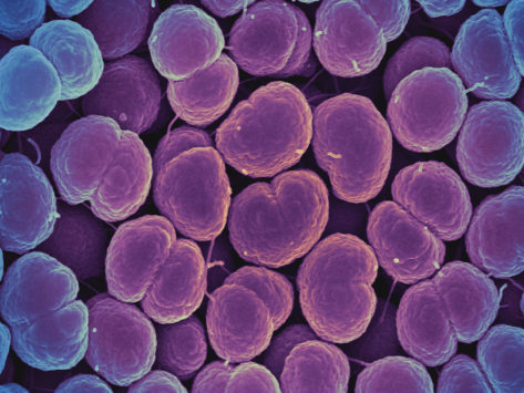 Nih niaid neisseria gonorrhoeae bacteria gonorrhea