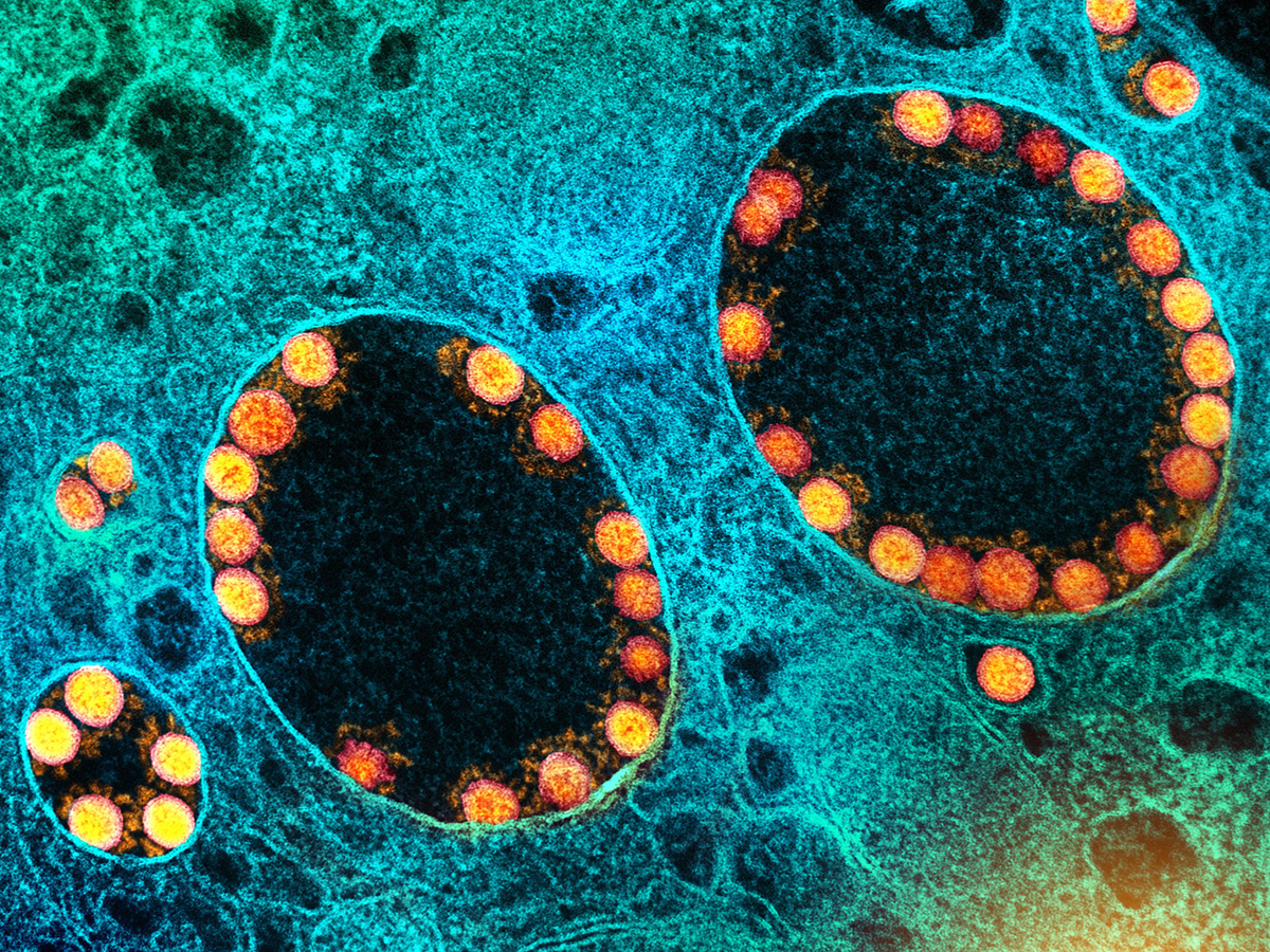 Nih niaid novel coronavirus sars cov 2 01