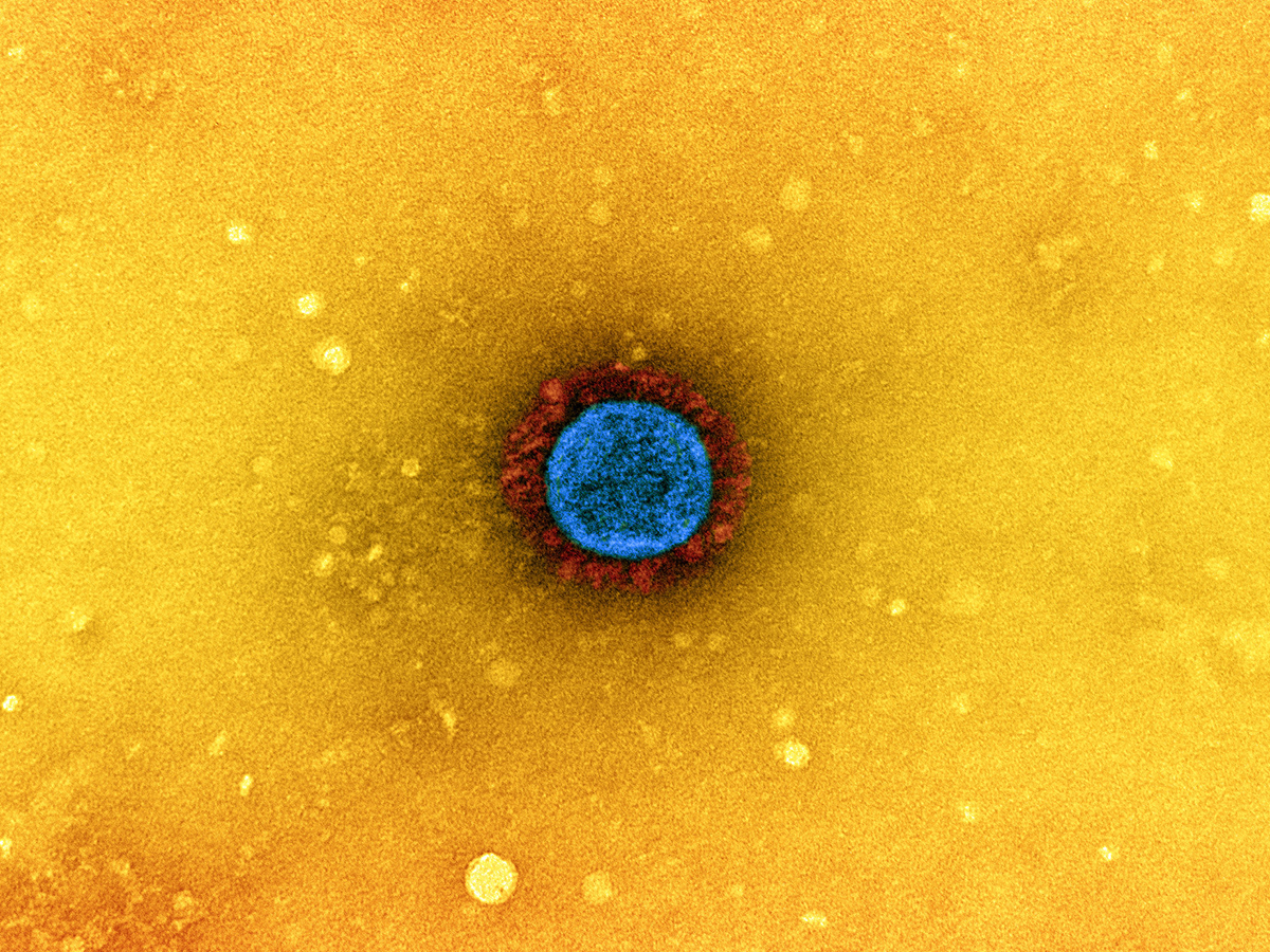 Colorized transmission electron micrograph of SARS-CoV-2 (UK B.1.1.7 variant).
