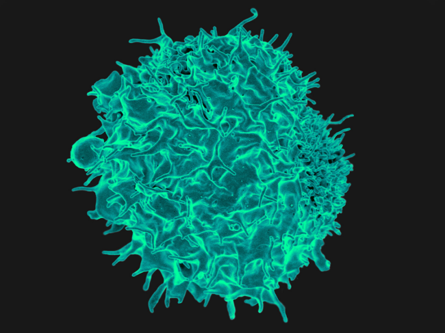 Colorized scanning electron micrograph of a T lymphocyte.