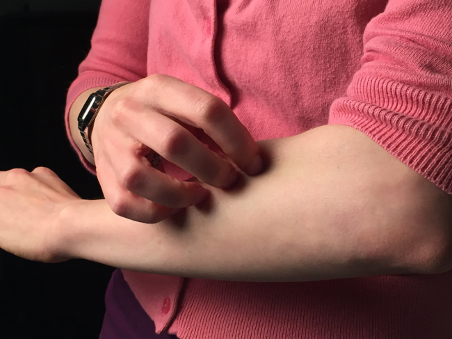 A woman scratches the skin on her forearm.