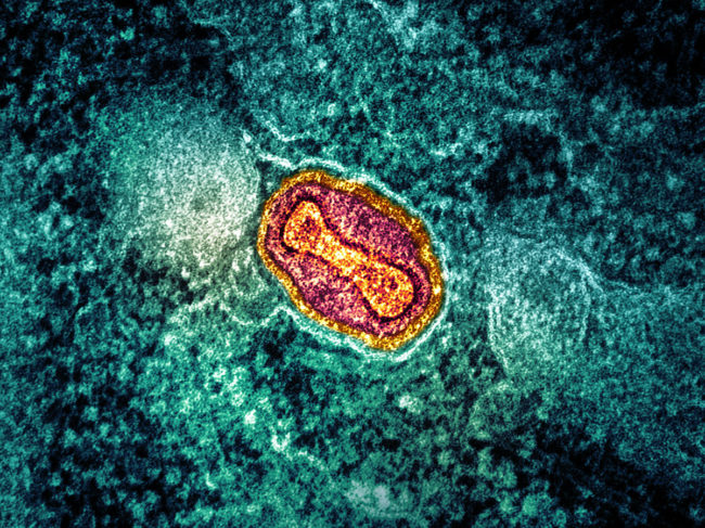 Colorized transmission electron micrograph of an mpox virus particle